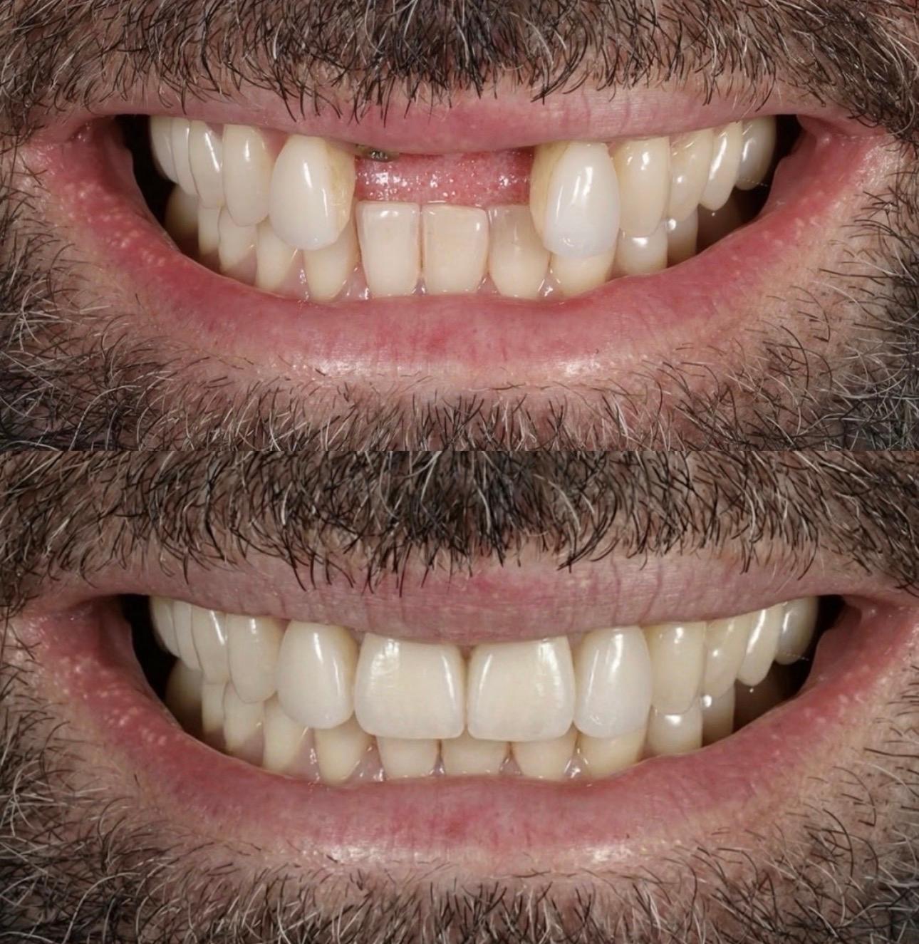 Hasta gülüş dönüşümü 26