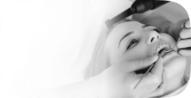 Genel Diş Tedavileri